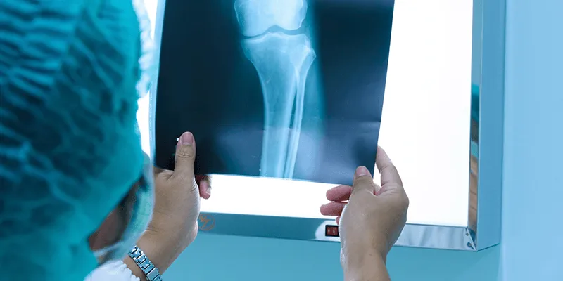 x-ray